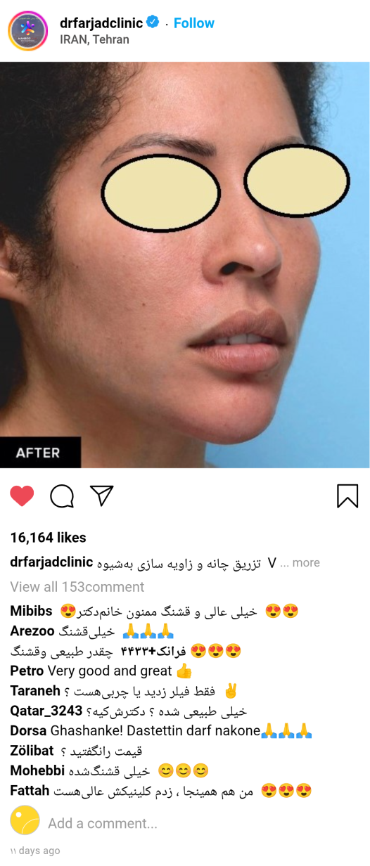 زاویه سازی تخصصی در کلینیک زیبایی ماهبد