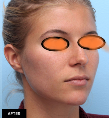 دکتر مه گل فرجادنیا، کلینیک زیبایی ماهبد، تزریق چانه کلینیک زیبایی ماهبد، تزریق چانه دکتر مه گل فرجادنیا، بهترین تزریق چانه در ظفر، بهترین تزریق چانه در جردن ، بهترین تزریق چانه در تهران ، بهترین تزریق چانه در ایران 