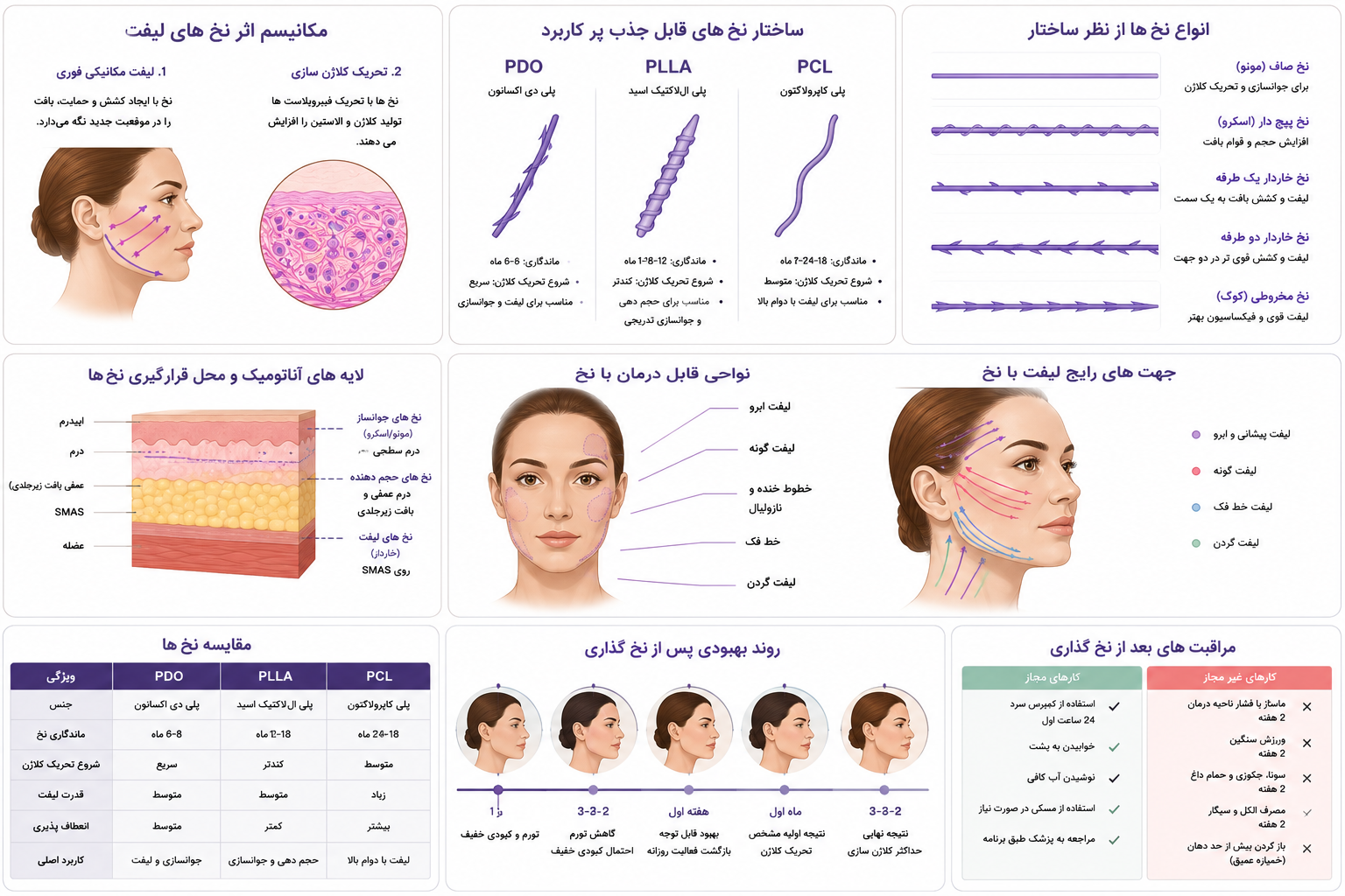 لیفت با نخ، انواع نخ ها از نظر ساختار و جنس، مکانیسم اثر، لایه های آناتومیک و محل قرار گرفتن نخ ها ، مراقبت های بعد از نخ گذاری، مقایسه نخ ها PCL، PLLA،PDO