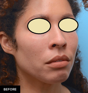 دکتر مه گل فرجادنیا، کلینیک زیبایی ماهبد، تزریق چانه ، تزریق زاویه فک، بهترین مرکز تزریق زاویه فک، بهترین مرکز تزریق چانه در ایران، بهترین مرکز تزریق چانه در تهران، بهترین مرکز تزریق چانه در جردن، بهترین مرکز تزریق چانه در ظفر، بهترین مرکز تزریق زاویه فک در شمال تهران