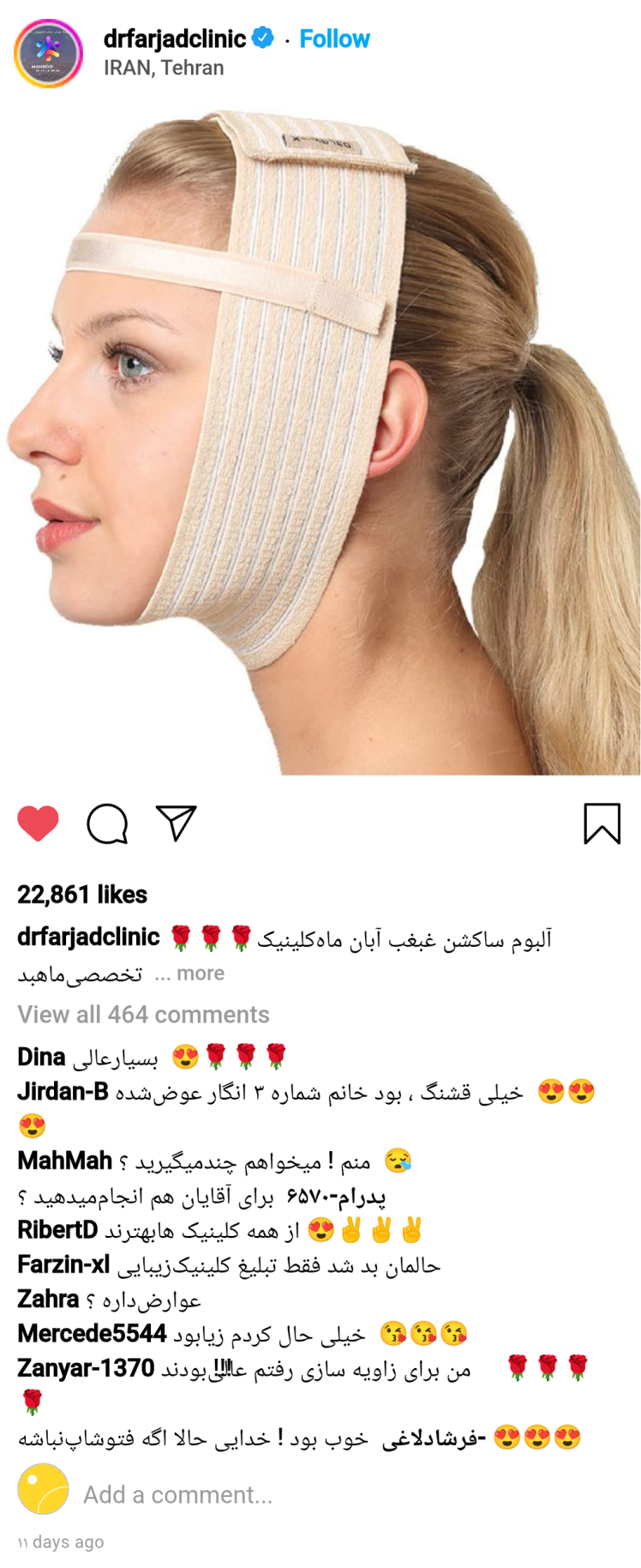 ساکشن غبغب / همه آنچه برای انجام آن باید بدانید